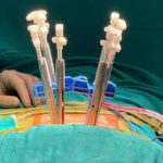 spine surgeon near me – Spine Surgeon Near Me - Expert Minimally Invasive Spine Care
