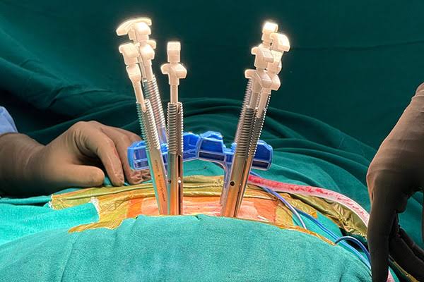spine surgeon near me – Spine Surgeon Near Me - Expert Minimally Invasive Spine Care